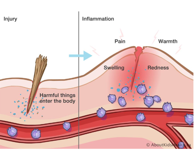 <p>Symptoms of Inflammation</p>