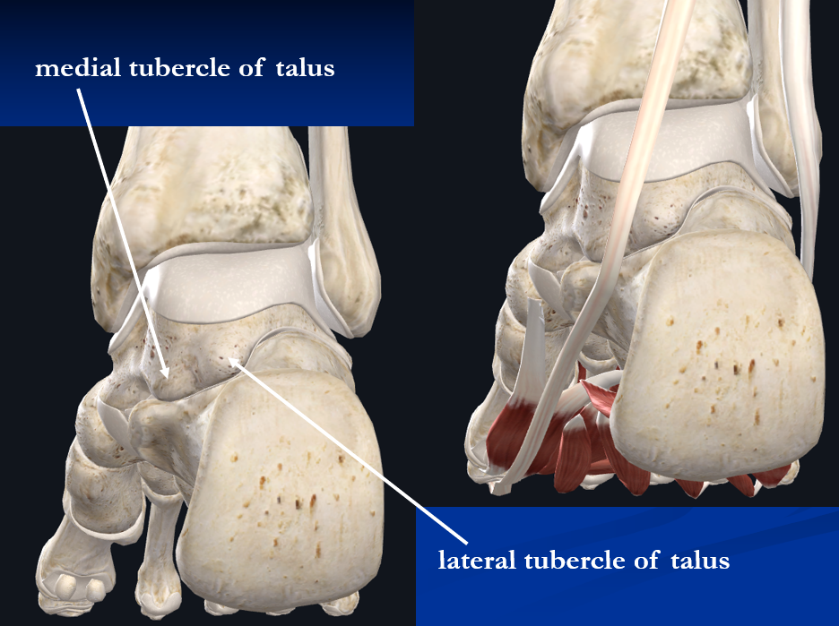 <p>The medial and lateral tubercles of the talus are pictured below. Together they form a small channel for the passage of one of the tendons of the foot. What is the name of the tendon that passes between these tubercles:</p>