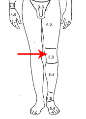 <p>Kneecap</p>