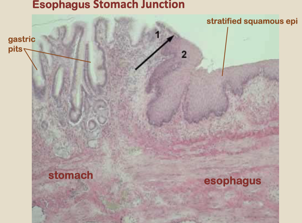 <p>esophagus / stomach junction: esophagus region, stomach region</p>