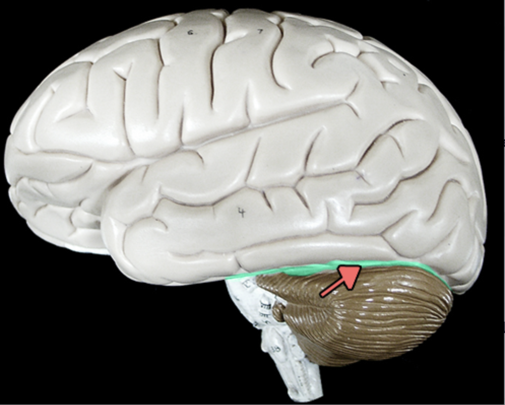 <p>between cerebrum and cerebellum, location of tentorium cerebelli Left and right cerebellar hemispheres Vermis</p>