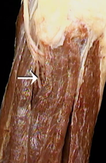 <p>Oppervlakkig, anterior zicht, zenuw</p>