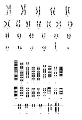 <ul><li><p>Graphic arrangement of chromosomes in a cell</p></li><li><p>Arranged by size, position of centromere</p></li><li><p>Numbered 1-22, X and Y</p></li></ul><p></p>