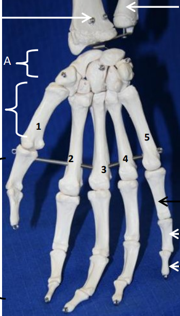 <p>What bone is this? What view of the bone is this?</p>