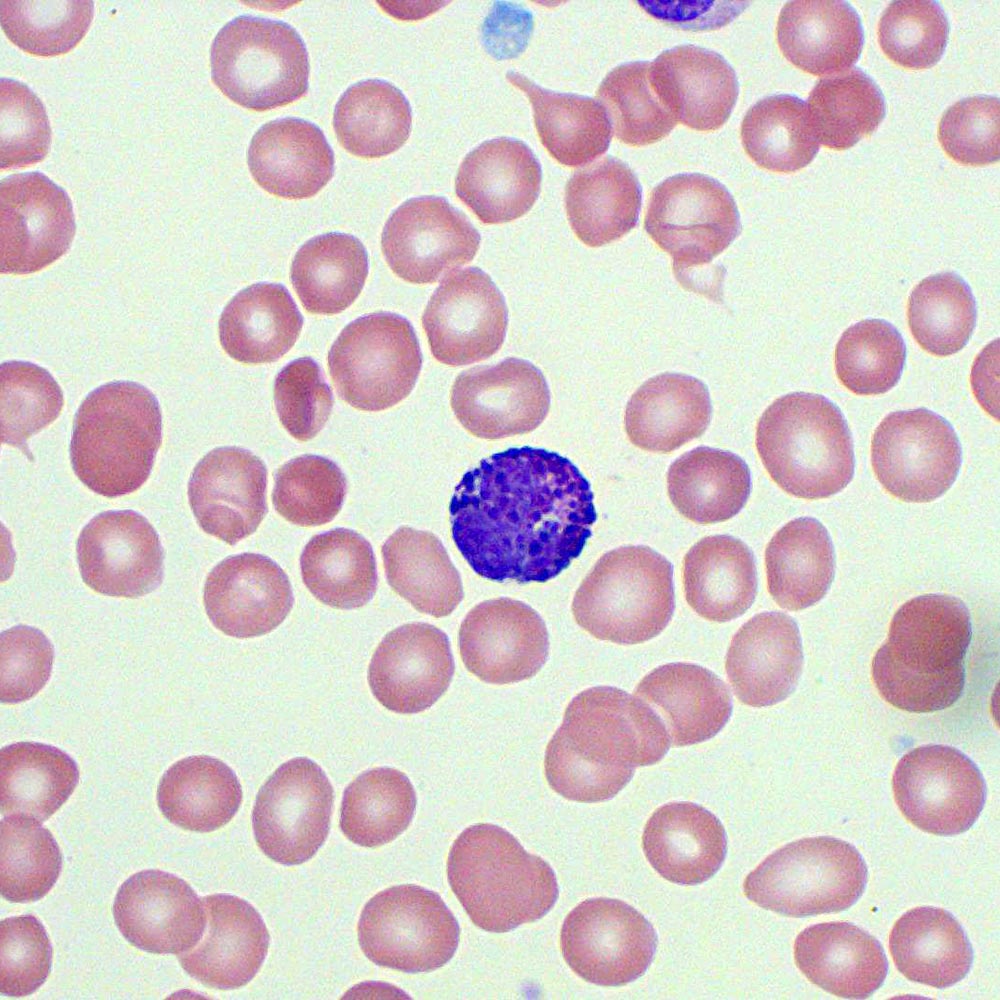 <p>Identify the leukocyte and approximate WBC Differential Ranges </p>