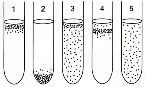 <p>Thioglycolate broth was inoculated with a single species of bacteria and incubated for 24-hours. Which term below is most correctly used to describe the growth pattern seen in tube 1?</p><p>A. Microaerophile</p><p>B. Facultative anaerobe</p><p>C. Aerotolerant anaerobes</p><p>D. Obligate anaerobe</p><p>E. Obligate aerobe</p>