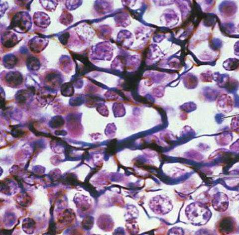 <p>reticular connective tissue</p>