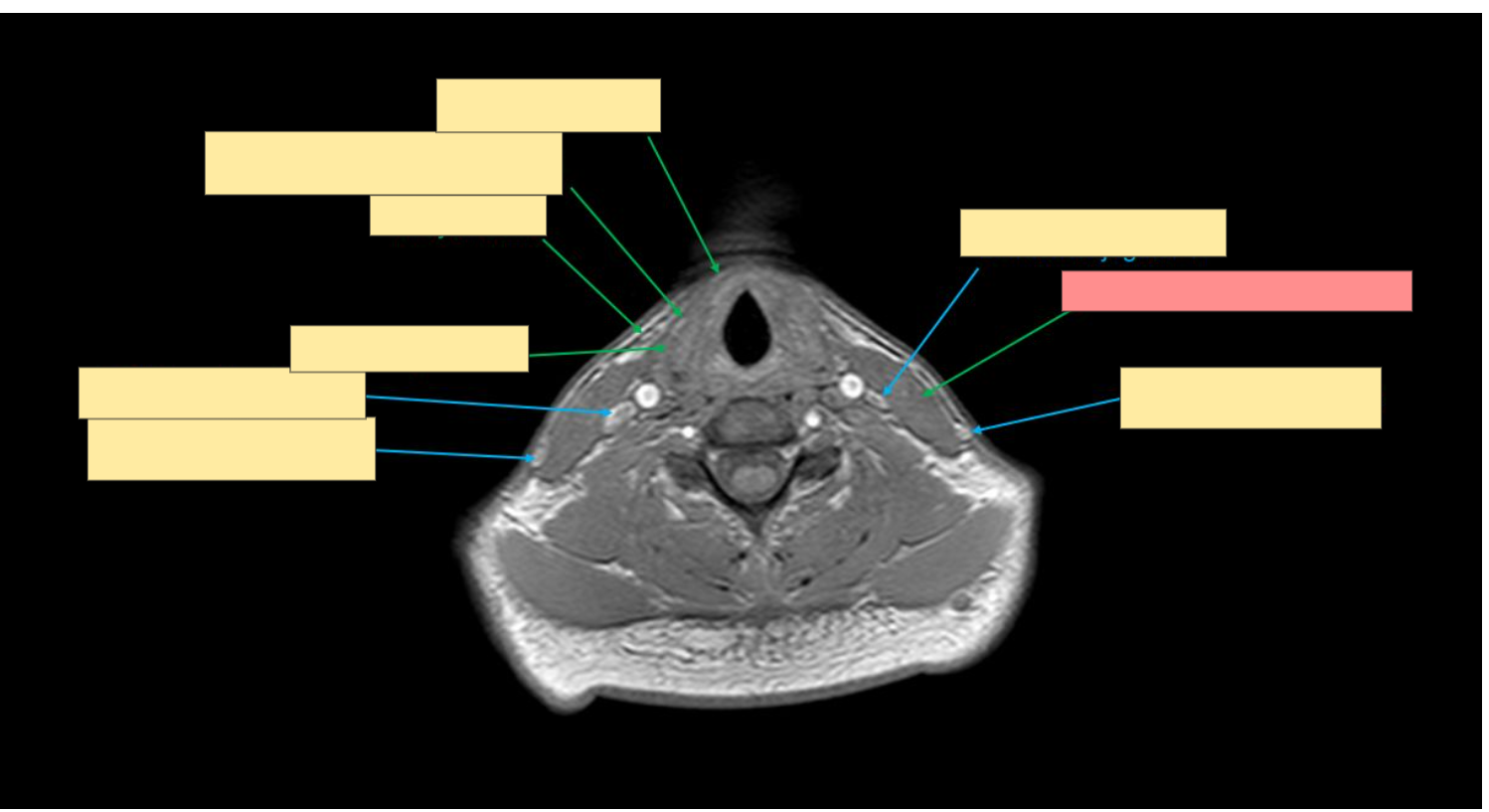 <p>Name this structure </p>