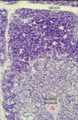 <p>Thymus.</p>