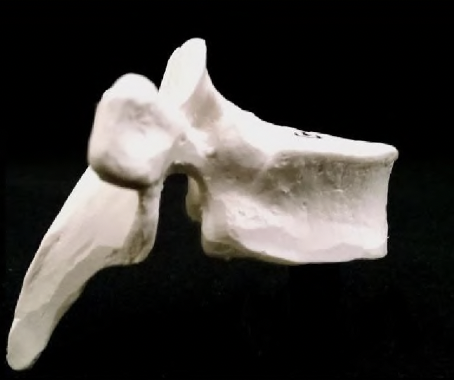<p>what vertebrae is this?</p>