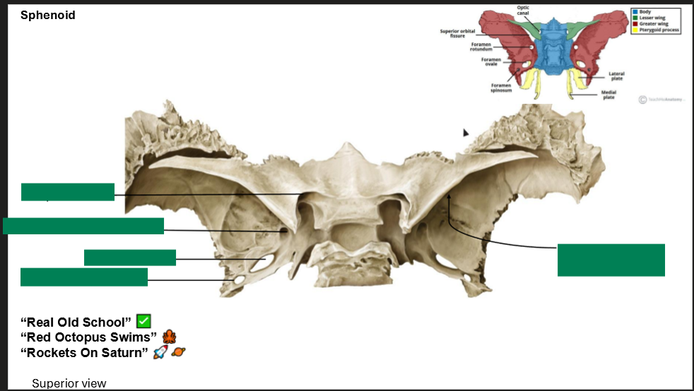 <p><strong>Label the Sphenoid</strong></p>