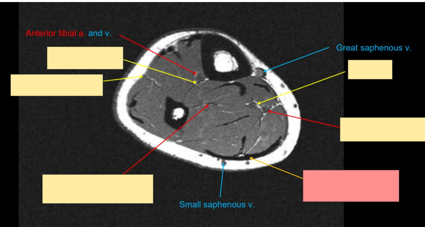 <p>Identify this structure</p>