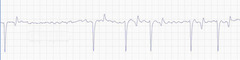 <p>Describe this horse ECG</p>