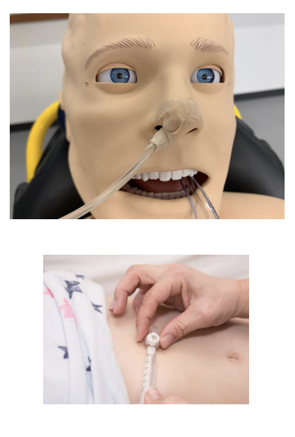 <p>Tube</p><p>Purpose: used to administer feedings and medication; can also function as a drain for GI contents when connected to suction</p>