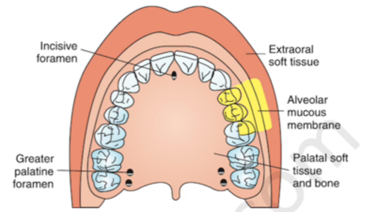 <p>What nerve block is this? (Distal to canine to MB root of 1st Molar)</p>