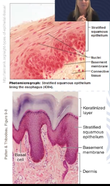 <p>Apical cells squamous, basal layer contains columnar or cuboidal cells</p><p>Top layer covered with dead cells filled with keratin (protein). seen in mammalian skin</p><p>Lines mouth cavity </p>