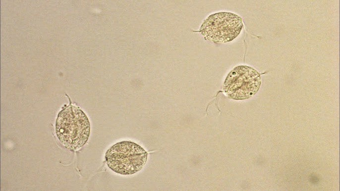 <p>Pear shaped trophozoite? Jerky motility? Two flagella poking out and wiggle? STI?</p>