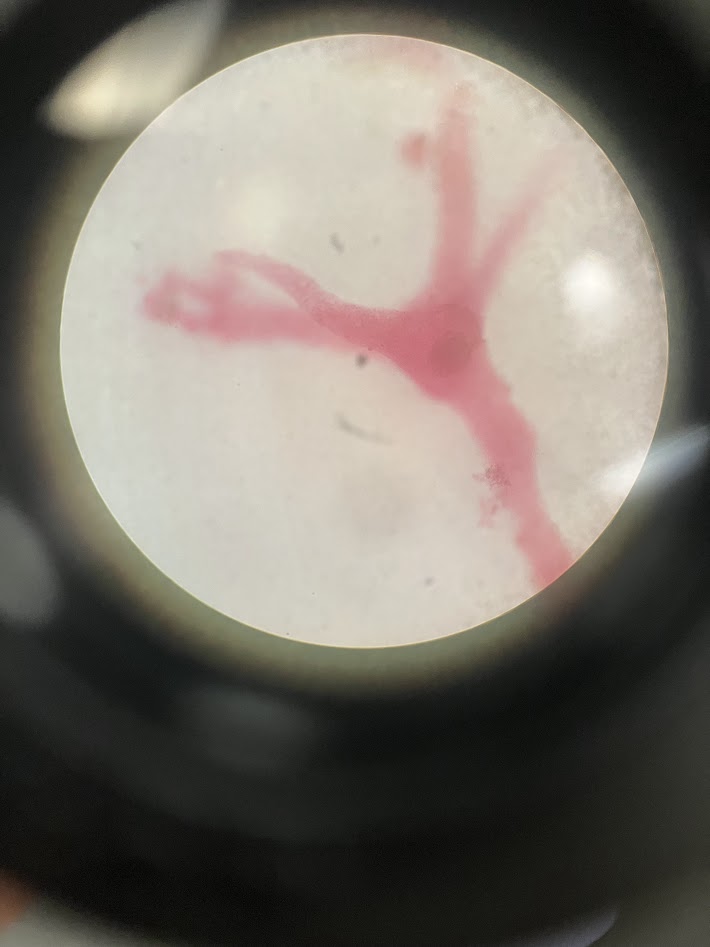 <ol><li><p>what is the phylum?</p></li><li><p>does this organism have pseudopodia?</p></li></ol><p></p>