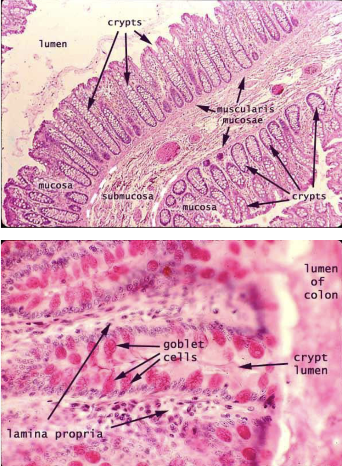 <p>Regions of Large Intestine, Tisssue, and infoldings </p>