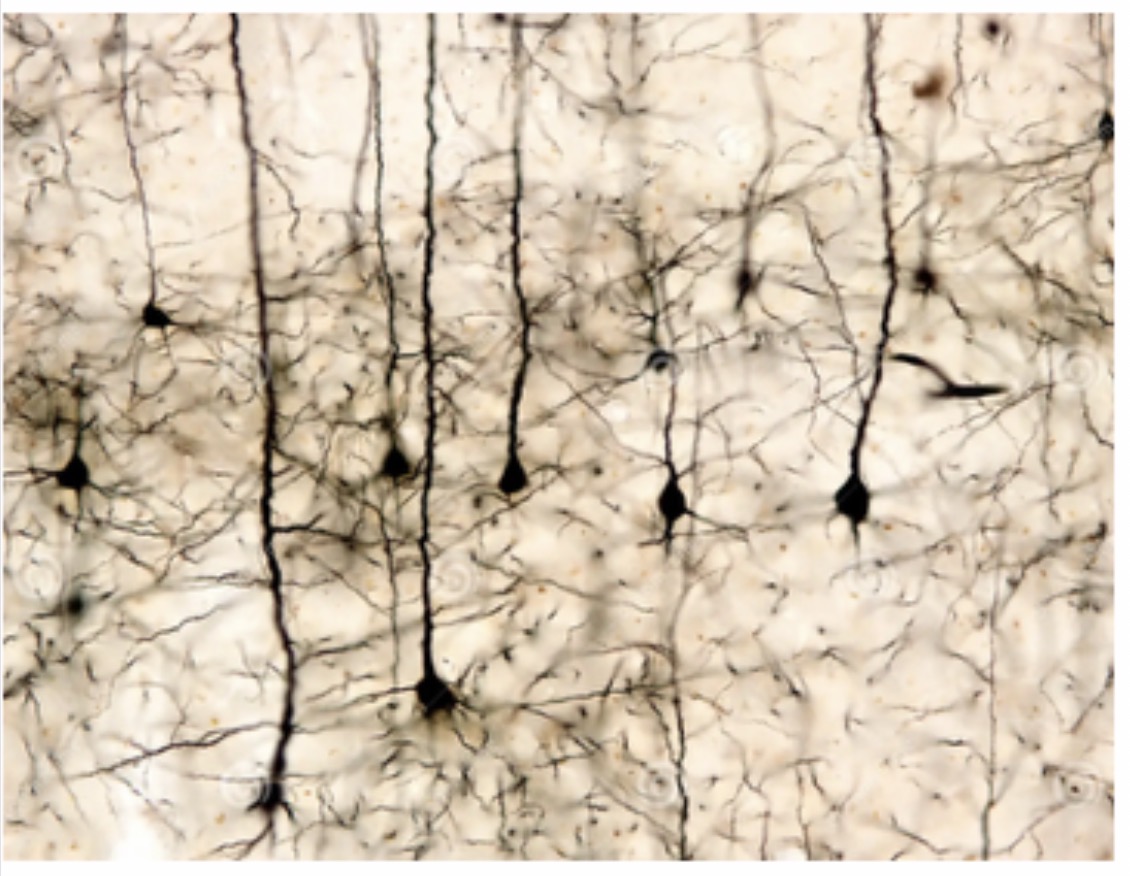 <p>Pyramidal Neuron : Function : Transmits impulses in the cerebral cortex and is involved in voluntary motor control and higher brain functions.</p>