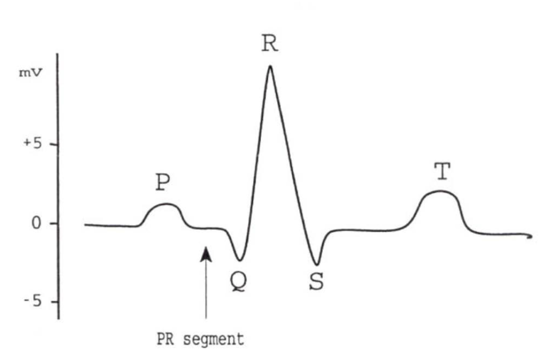 <ul><li><p><span style="color: rgb(0, 0, 0);">Because body fluids are good conductors, sensitive electrodes<br>placed on the body surface can record the fluctuations in electrical potentials that represent the sum of the action potentials of myocardial fibers if the rest of the muscles are kept still. The recording of these potential fluctuations is called <strong>ECG</strong></span></p></li><li><p><span style="color: rgb(0, 0, 0);">The heart's basic rhythm is set by impulses that are generated by depolarization of cells in the <strong>sinoatrial (SA) node</strong>, or pacemaker</span></p></li><li><p><span style="color: rgb(0, 0, 0);">This depolarization spreads over a conductive<br>system of specialized muscle cells and over the atria. The atria respond with contraction of the myocardial cells.</span></p></li><li><p><span style="color: rgb(0, 0, 0);">The propagation of depolarization via the conductive system then reaches the <strong>atrioventricular (AV) node</strong>, where it is delayed for 200 ms in order to give time for the atrial blood to flow into the ventricles. </span></p></li><li><p><span style="color: rgb(0, 0, 0);">It then continues quickly over the bundle of His and then spreads<br>over the ventricles via the <strong>Purkinje</strong> <strong>fiber</strong>. Next, the ventricles respond with contraction to eject the blood</span></p></li></ul><p></p>