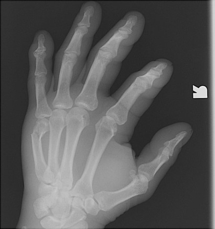 <p>What is the diagnosis?</p>