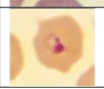 <p>RBC parasite</p>