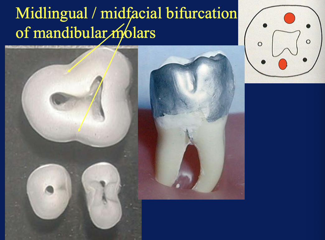 <ol><li><p><strong>mid-lingual</strong> bifurcation</p></li><li><p><strong>mid-facial</strong> bifurcation</p></li></ol><p></p>