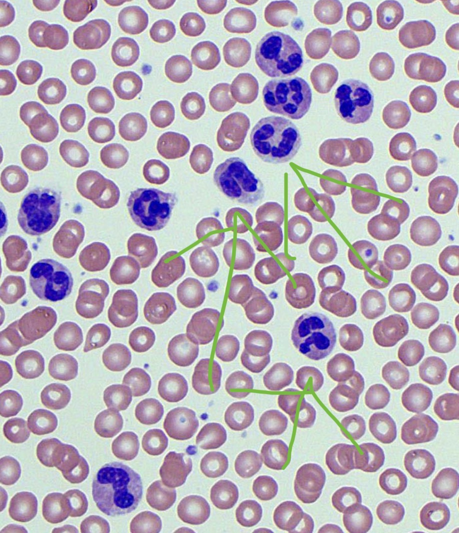 <p>Most common leukocytes, <span>Granules show up the most clearly with stains that are chemically neutral</span></p><p class="s13"><span>○Granules are usually light lilac</span></p><p class="s13"><span>○Nucleus is lobed with 2-5 lobes depending on the age of the cell</span></p><p class="s13"><span>○Rapid responders to infection; phagocytes</span></p><p class="s13"><span>○Granules include lysozymes and other digestive enzymes</span></p>