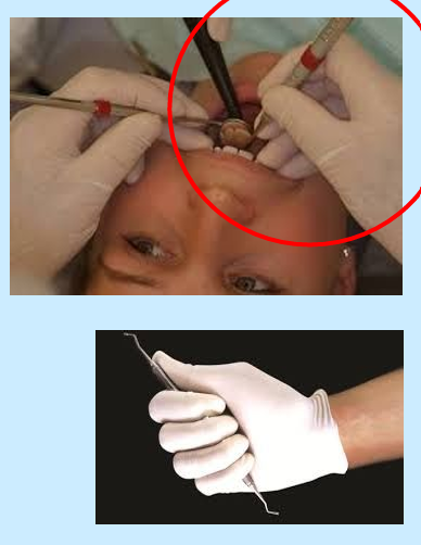 <p>Modified pen grasp- retraction<u> tongue and cheeks</u>.</p><p>Palm Grasp- retracting the upper and lower <u>lip</u> for visualization of facial/labial surfaces</p>