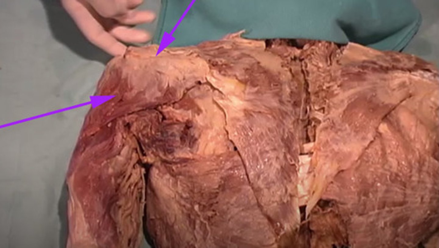 <p>What is the name of the structure as indicated by the arrow?</p>