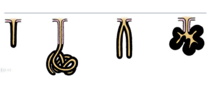 <p>Left to right:</p><ol><li><p>simple tubular</p></li><li><p>simple coiled tubular</p></li><li><p>simple branched tubular</p></li><li><p>simple branched acinar</p></li></ol><p></p>