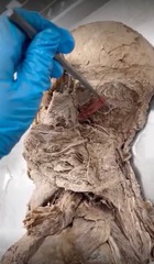 <p>Name the muscle</p>