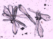 <p>What type of crystal is this?</p>