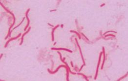 <p>What morphology?</p>