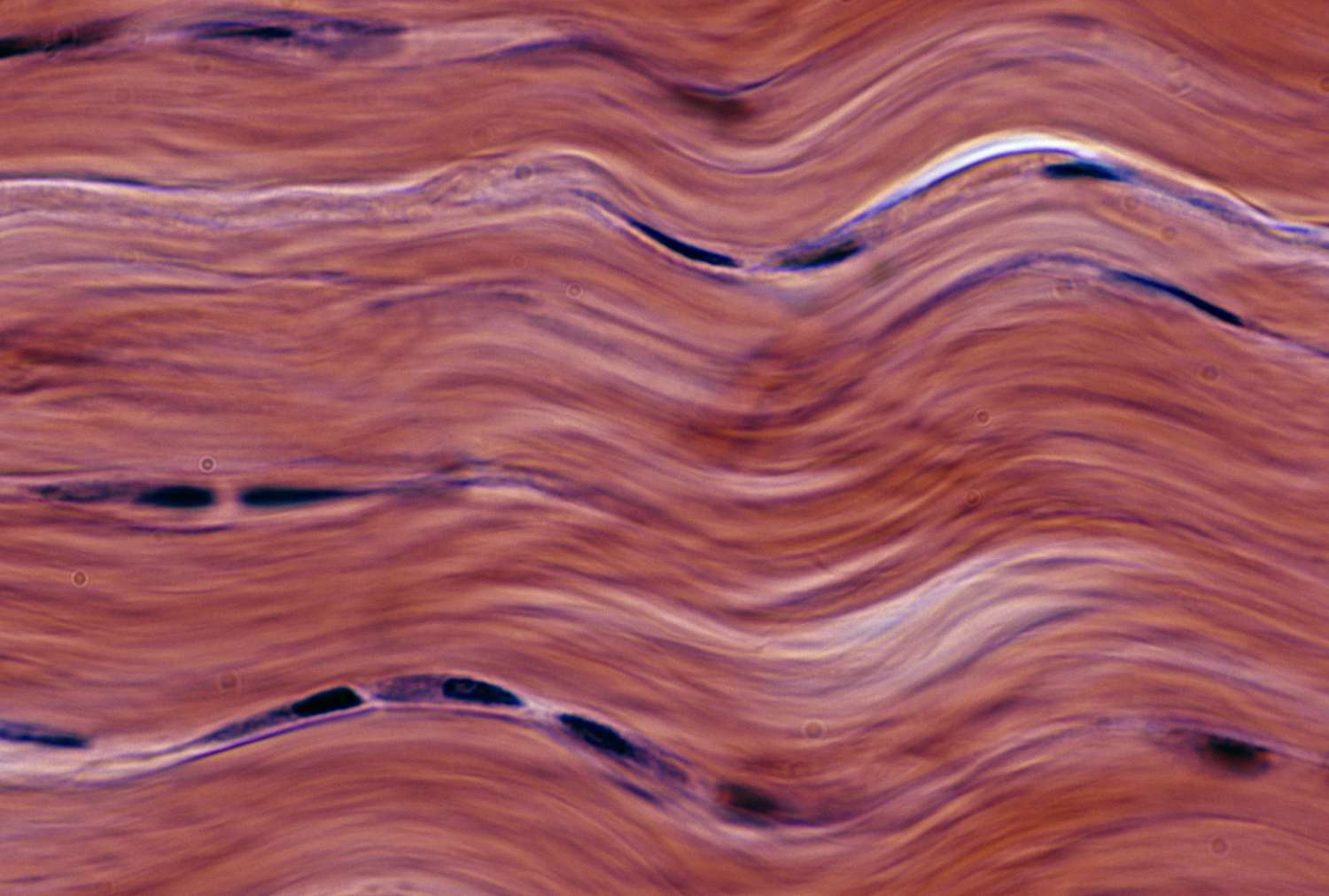 <p>-Function: Provides strong support and resists stretching and pulling</p><p>-Found: Tendons, ligaments, and dermis of the skin</p><p>-Description: Densely packed collagen fibers with few cells (fibroblasts)</p>