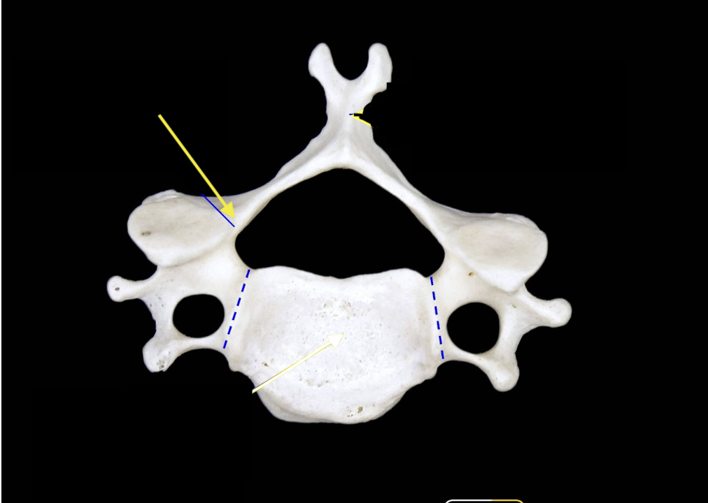 <p>Identify what the arrow is pointing at</p>