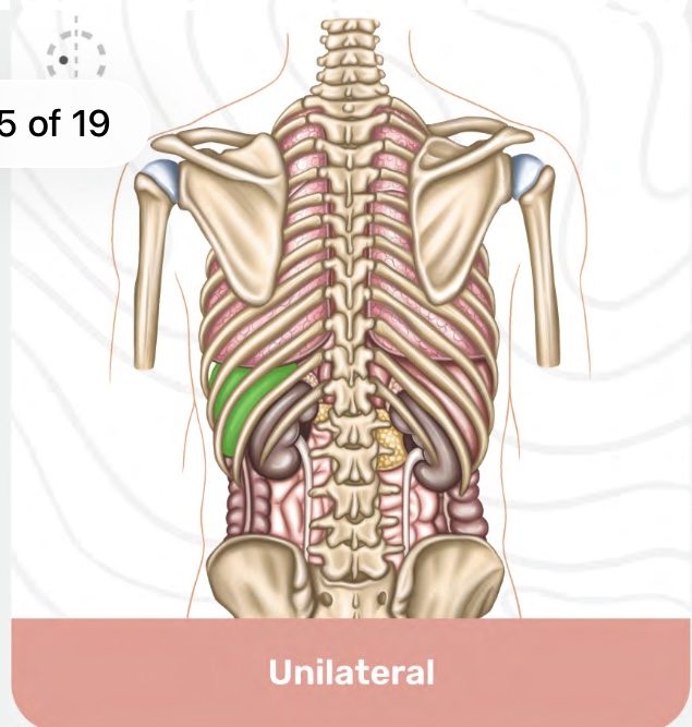 <p>Unilateral</p>