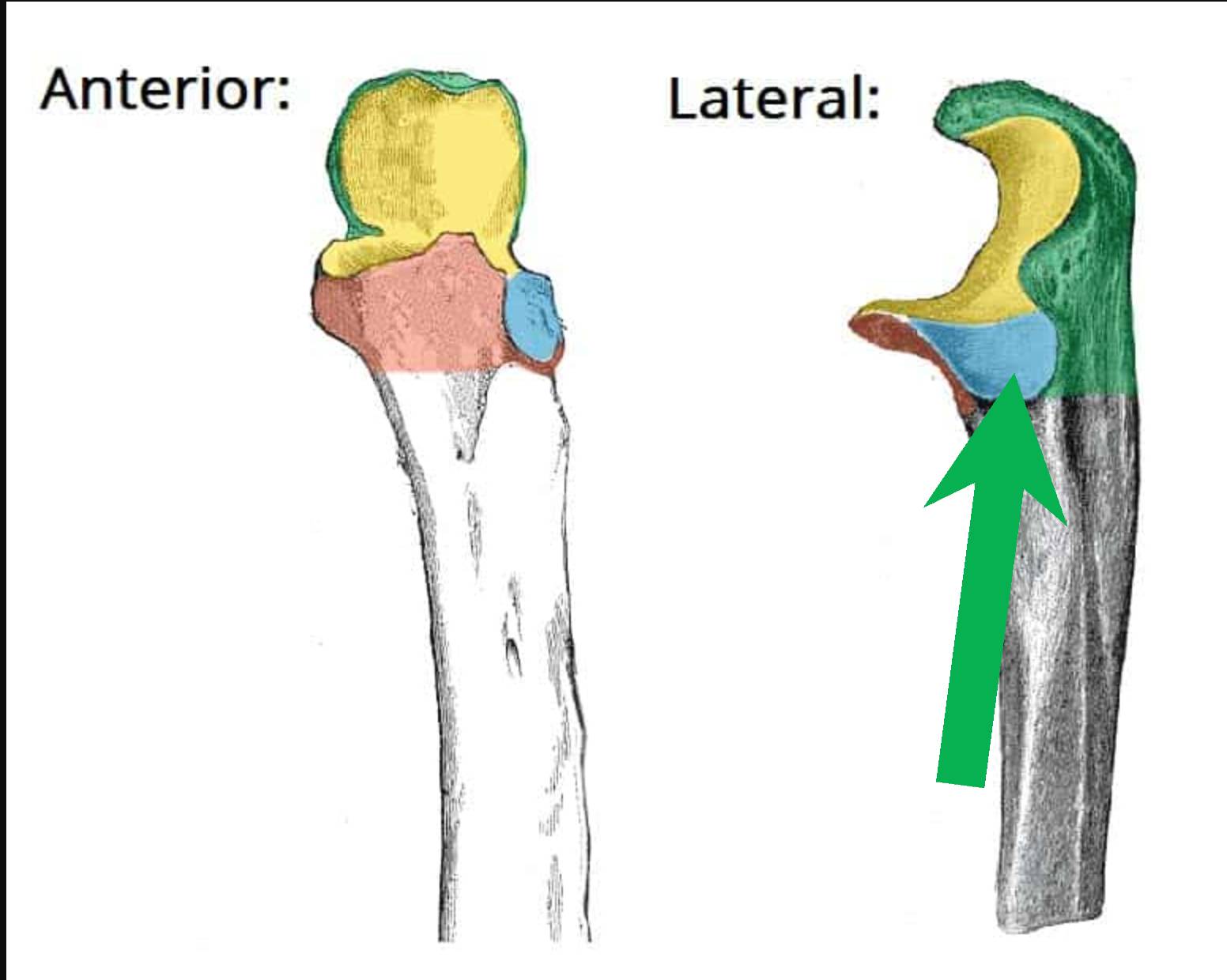 term image