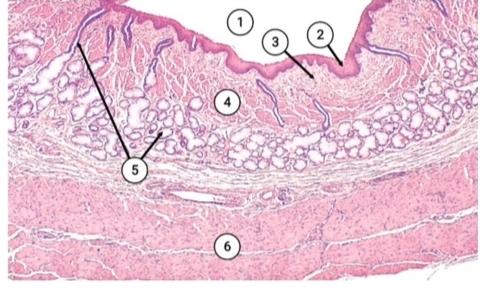term image