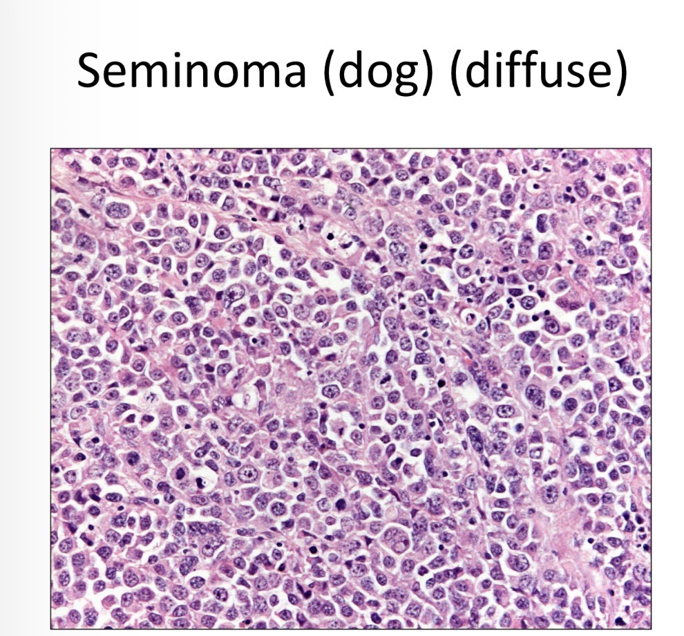 <p>Poor demarcation </p>