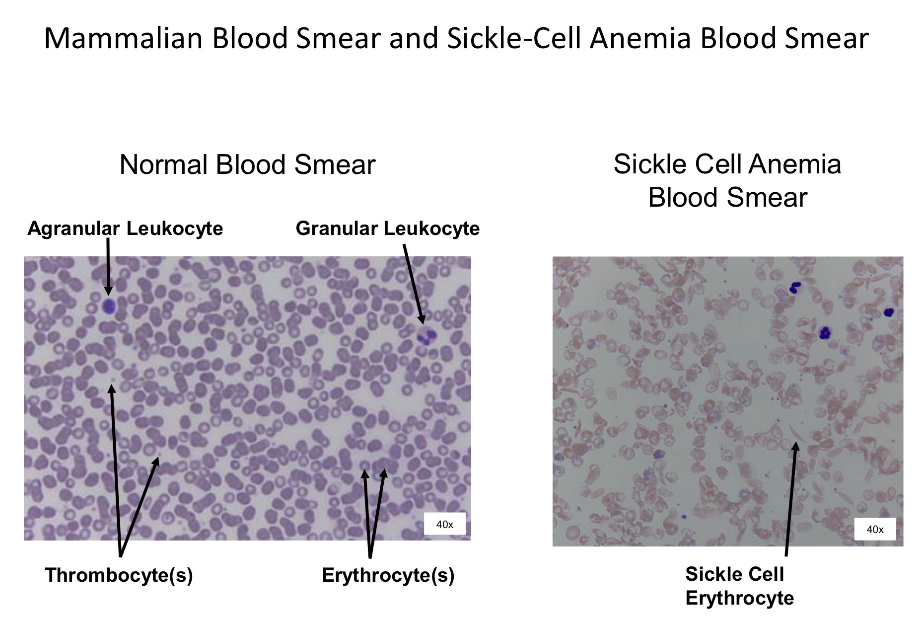 <ol><li><p>Agranular Leukocyte</p></li><li><p>Granular Leukocyte </p></li><li><p>Thrombocyte</p></li><li><p>Erythrocytes</p></li><li><p>Sickle cell erythrocyte </p></li></ol><p></p>