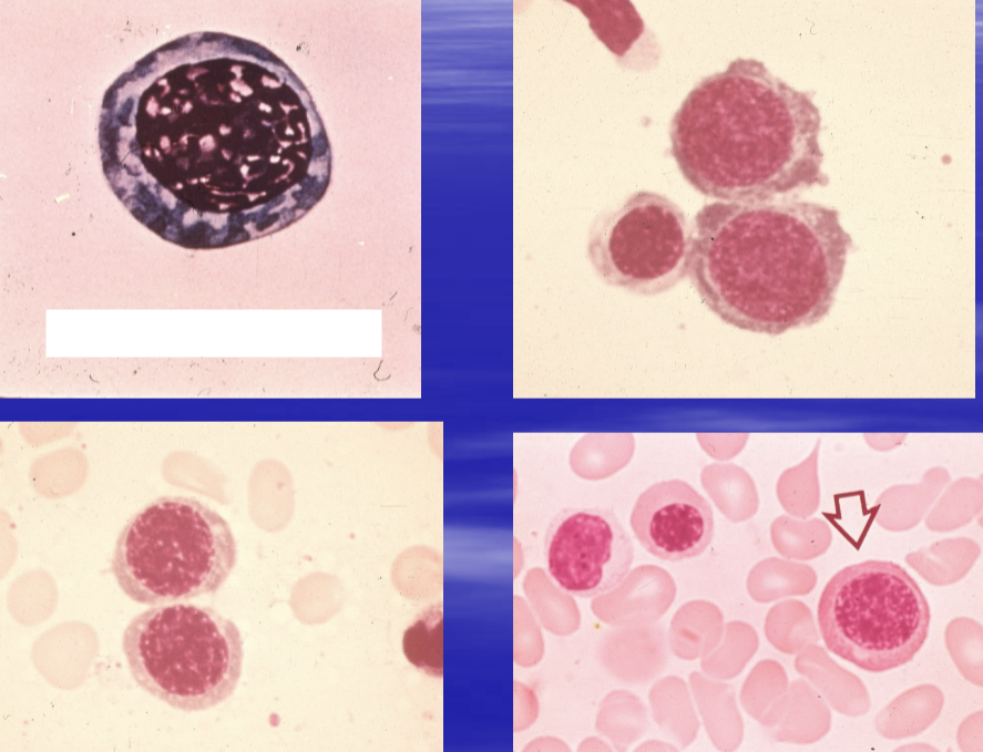 <p>chromatin beginning to condense, nucleoli indistinct or not visible. cytoplasm more abundant &amp; deeply basophilic. 1-3% in bone marrow</p>