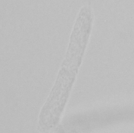 <p>Most frequently seen</p><p>Almost see-through, rounded edges</p><p>Normal, only pathological in large numbers</p>