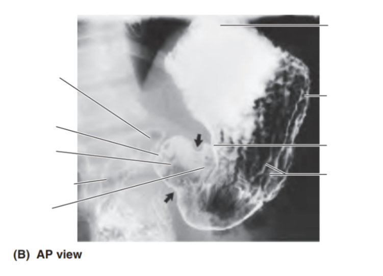 <p>Please label </p>