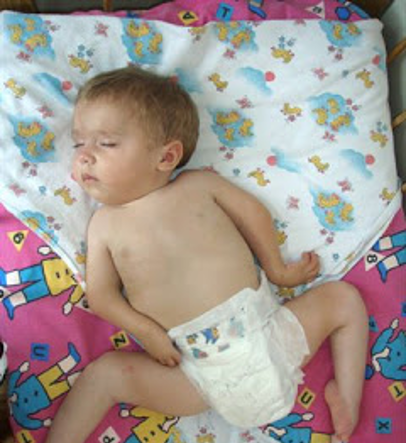 <p>hip abduction and ER</p>