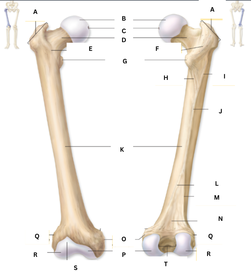 <p>label the femur </p>