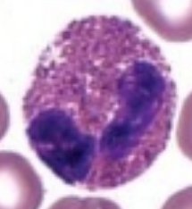 <p>what is it (Staining Blood Smears)</p>