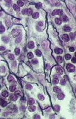 <p>function; transport respiratory gases, nutrients, wastes, and other substances.</p><p>Location: contained within blood vessels</p>