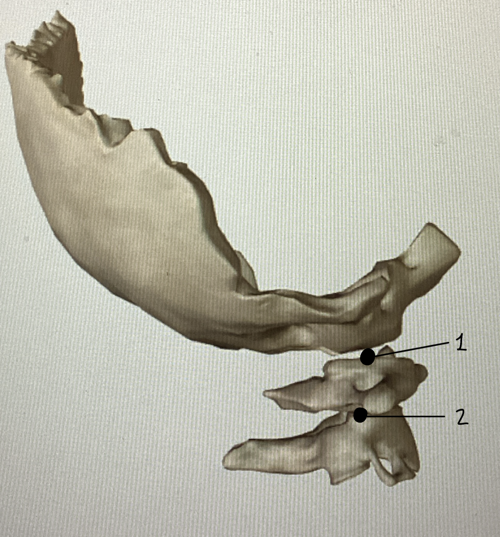 <p>Name these joints (and function)</p>